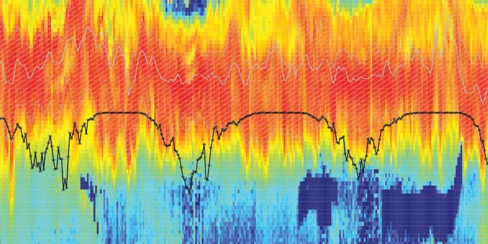 Echogram